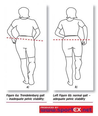 trendelenburg test vs hip drop test|what is positive trendelenburg sign.